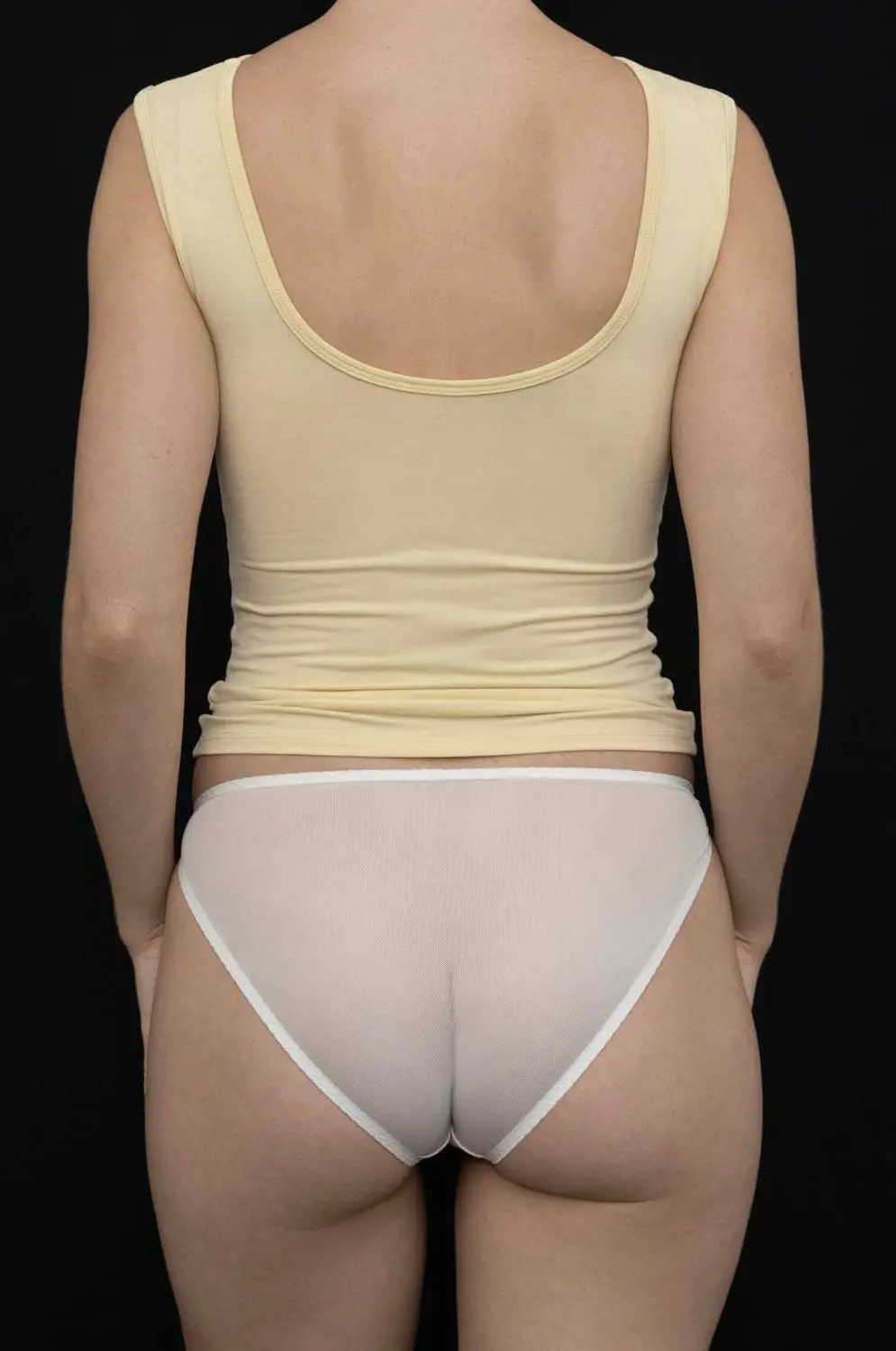KYE INTIMATES RECLINE BATEAU SLEEVELESS - LIMONCELLO - Image 3